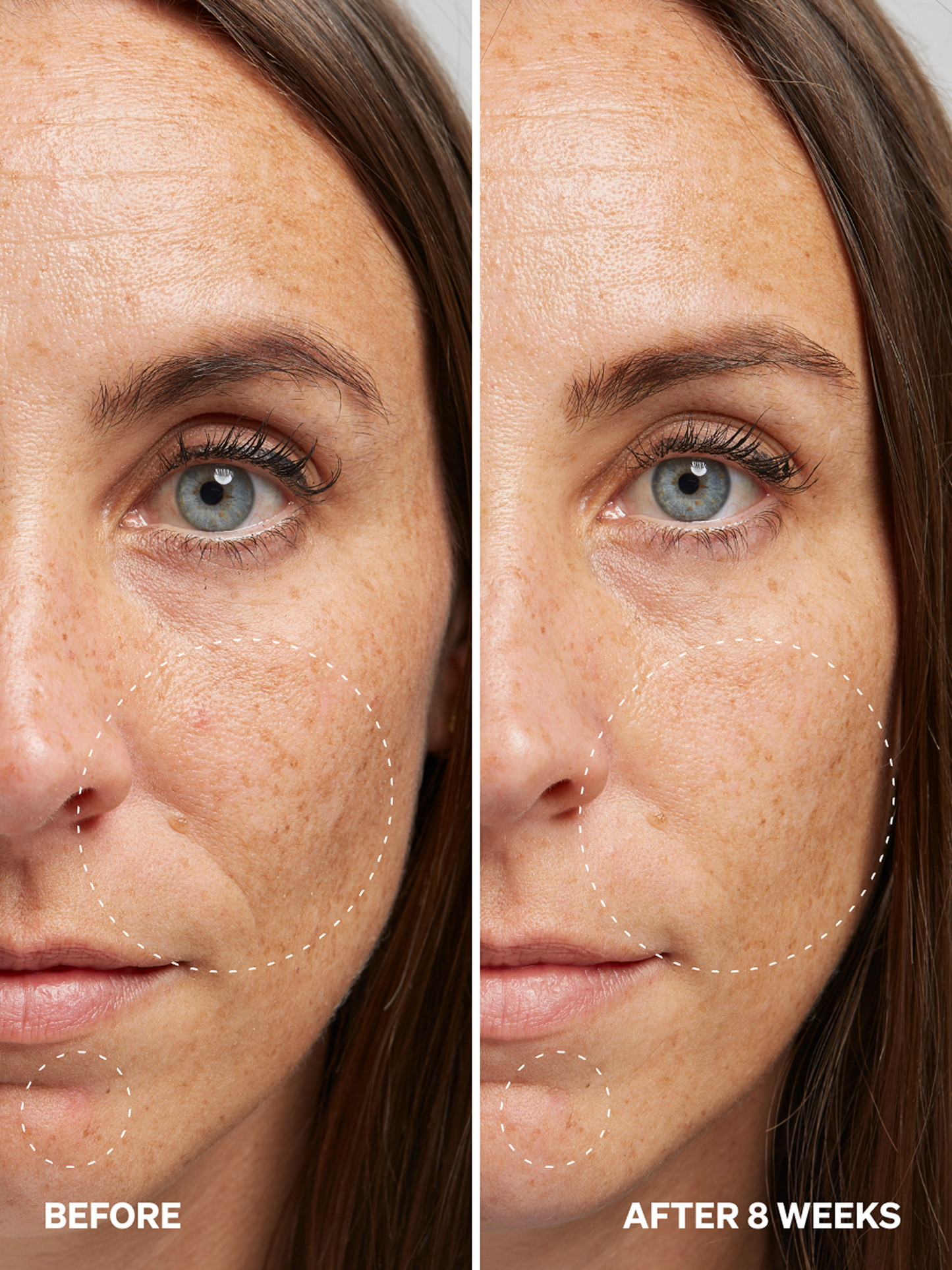 Alpha Arbutin 2% NEW