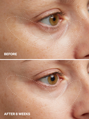 HPR Retinoid 0.3% NEW