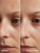 HPR Retinoid 0.3% NEW