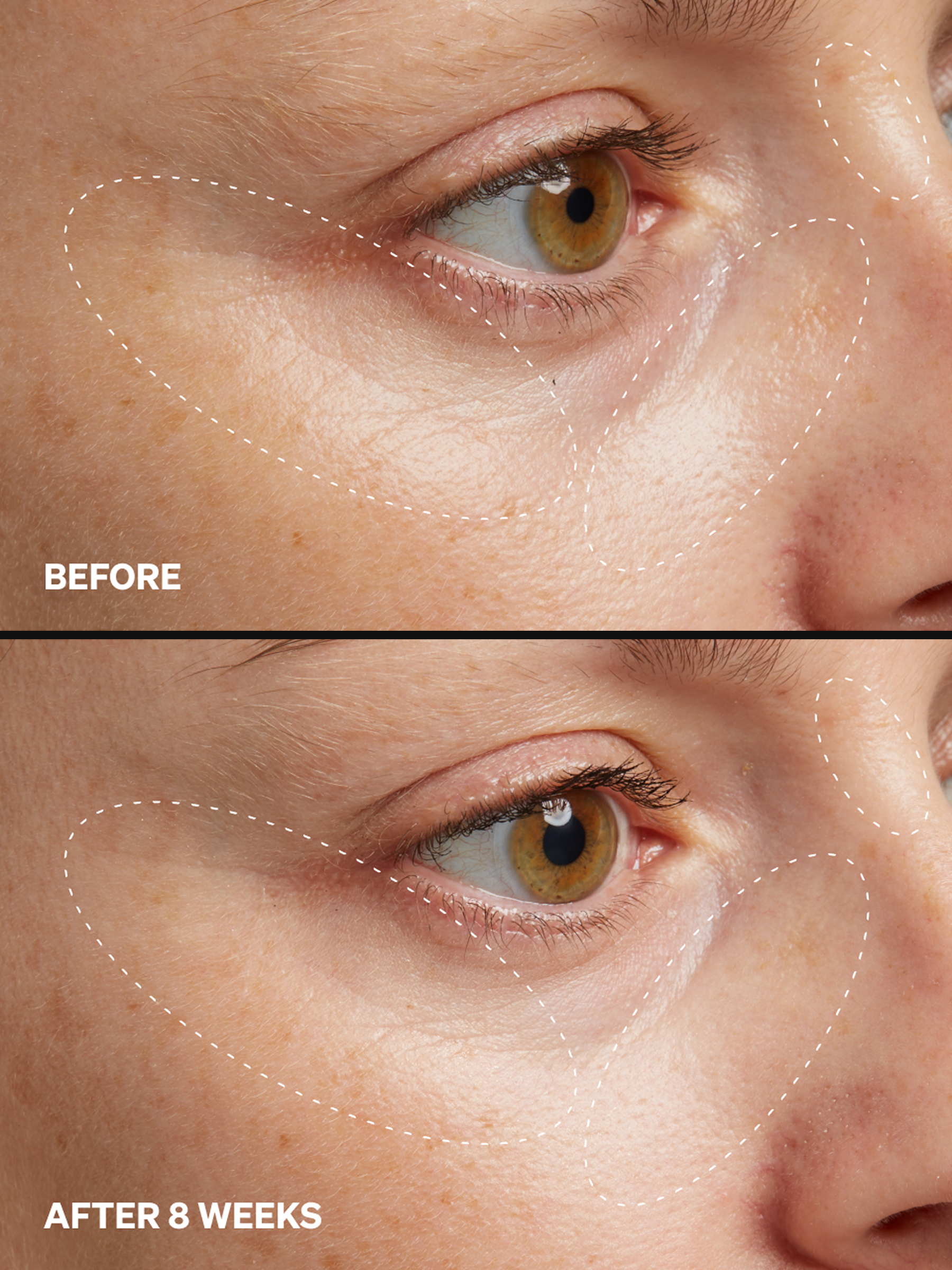 HPR Retinoid 0.3% - Onélogy