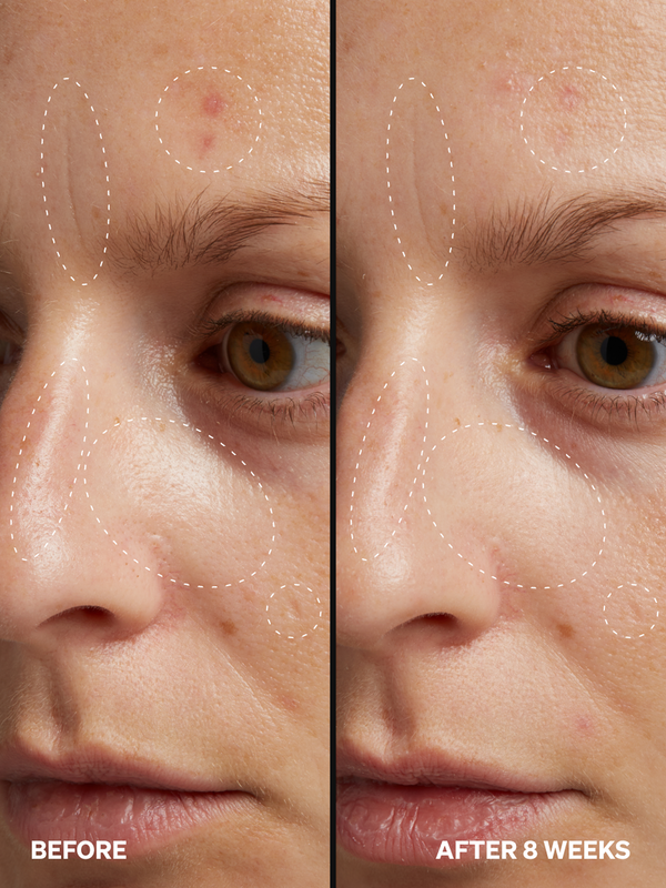 HPR Retinoid 0.3% - Onélogy